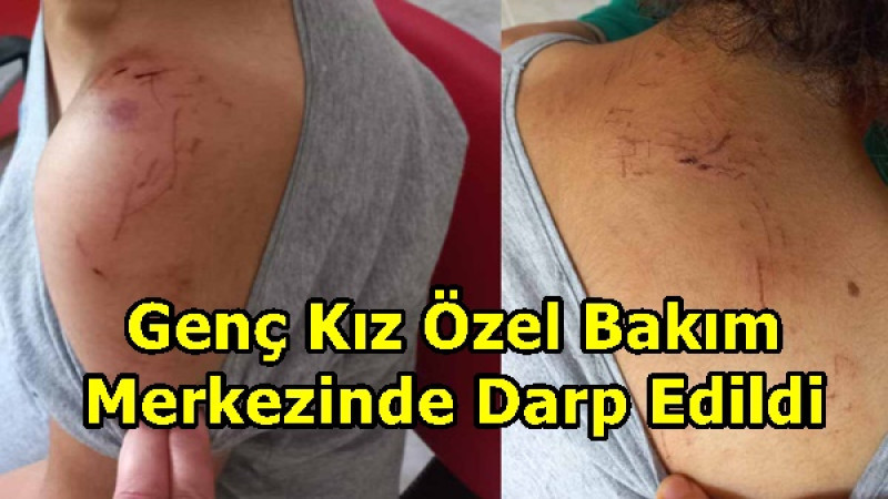 Genç Kız Özel Bakım Merkezinde Darp Edildi